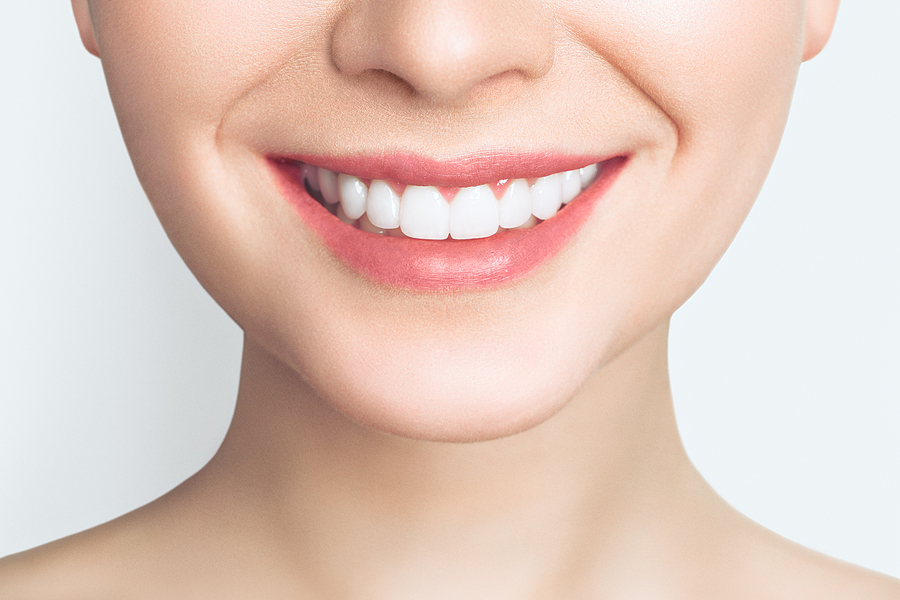 Achieve the Perfect Smile: A Comprehensive Guide to Smile Makeovers in Kilgore, TX